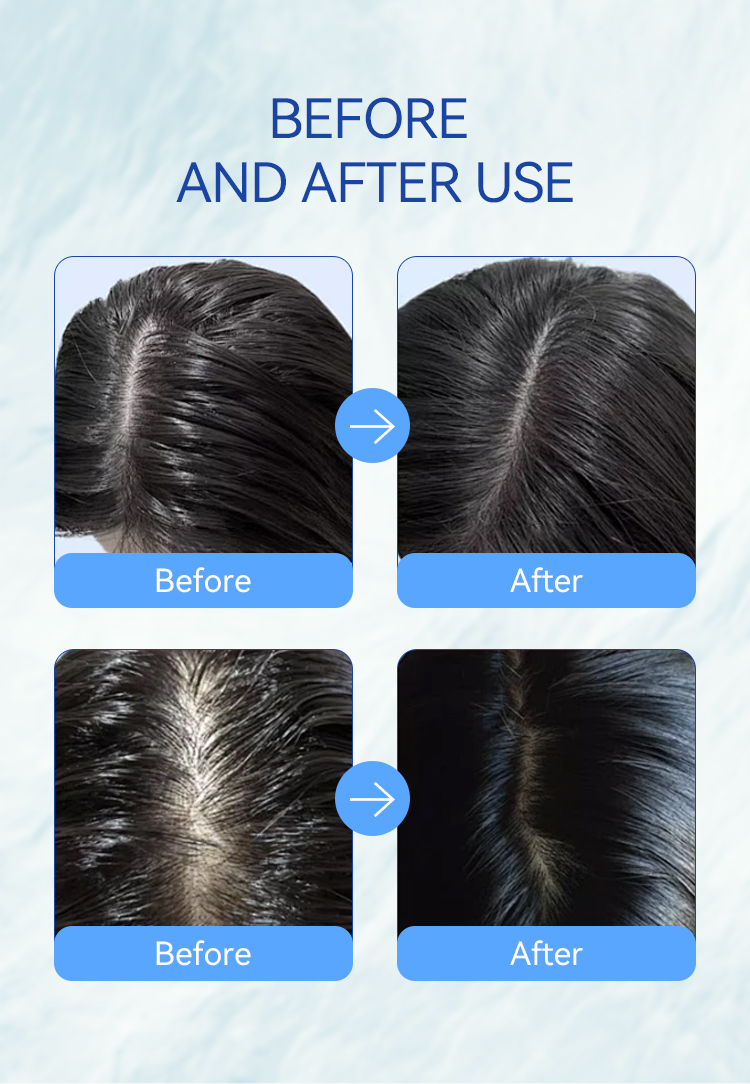 MUSK外贸-详情750-蓝色款_08 